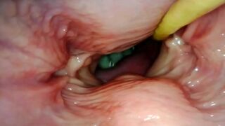 AMAZING INTERNAL POV. CAMERA INSIDE HER PUSSY WHILE I FILL HER WITH CUM