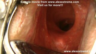 XO speculum and extreme deep anal dildo by Hotkinkyjo