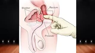 g-spot
