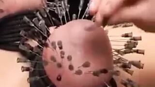 Needles in tits